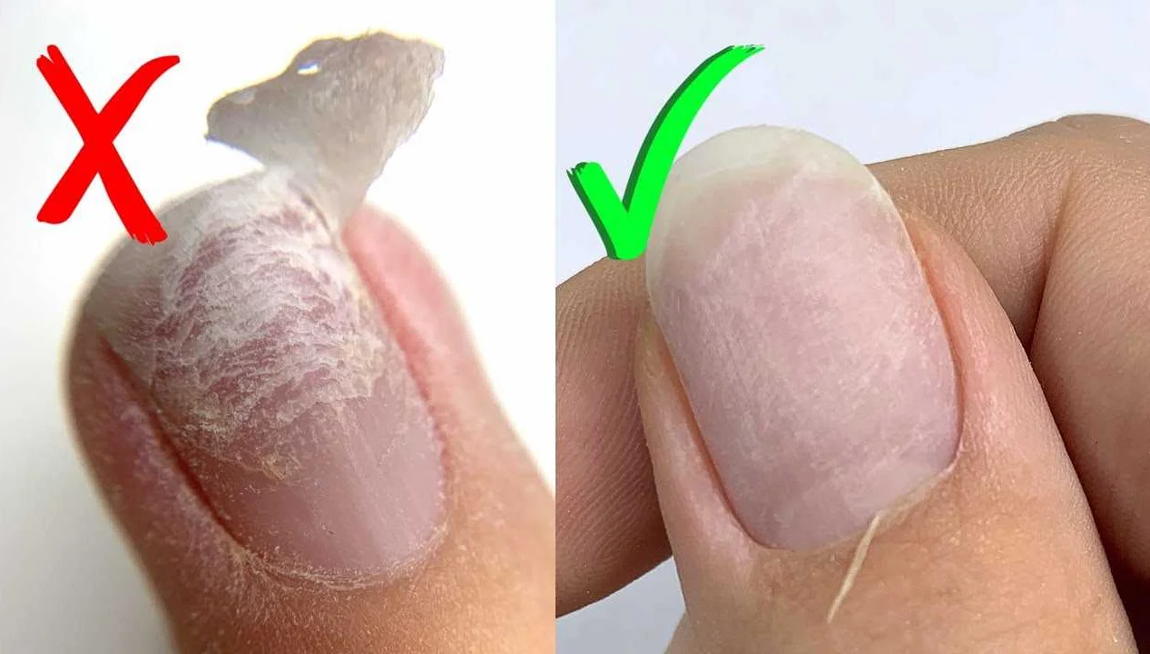 Советы дерматолога по уходу за ногтями