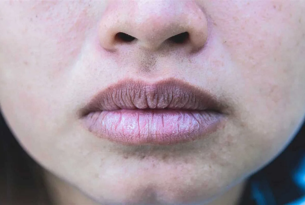Диагностика синих губ у пожилых людей