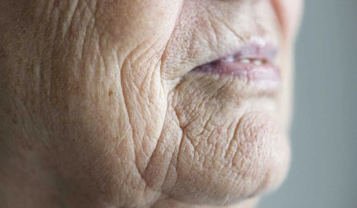 Симптомы синих губ у пожилых людей