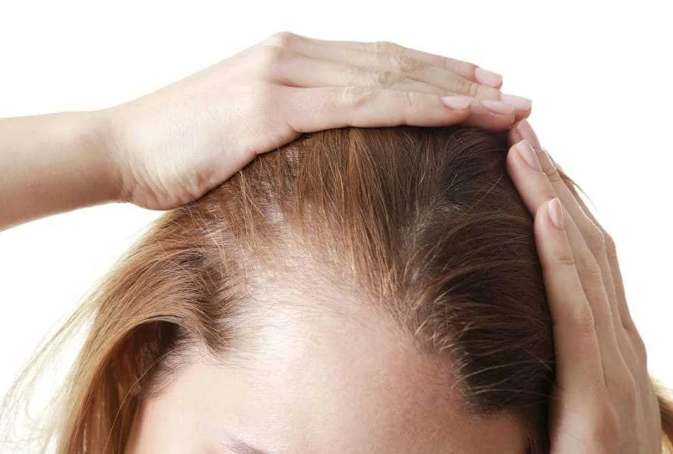Хирургические методы восстановления волос