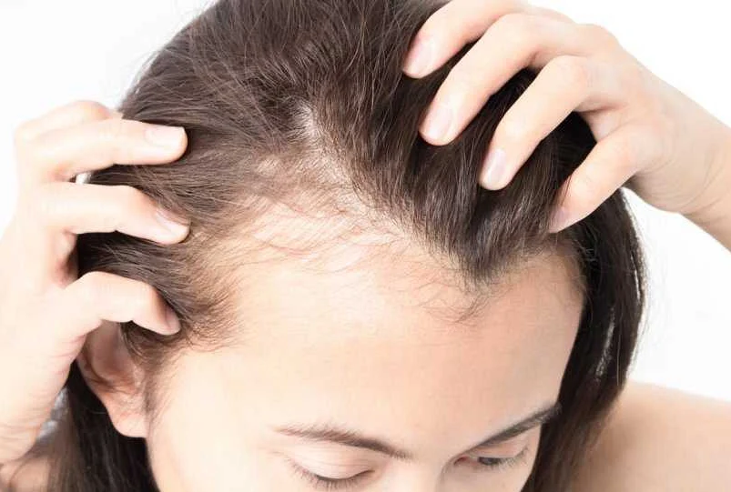 Повреждение волос и кожи головы при некорректном уходе
