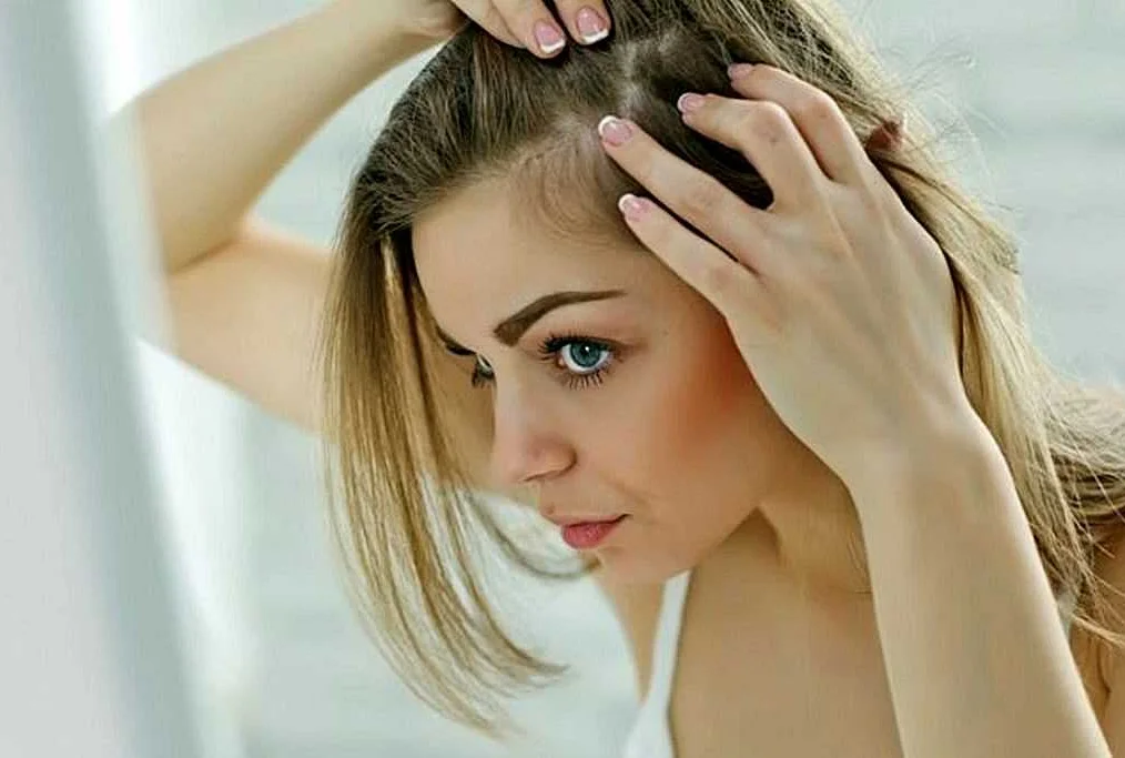 Традиционные методы лечения выпадения волос