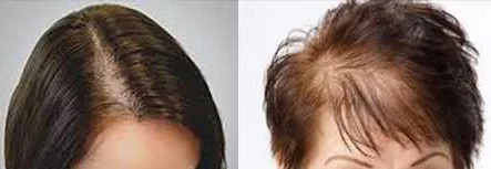 Популярные методы и средства для укрепления волос