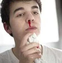 Как предотвратить кровотечение из носа