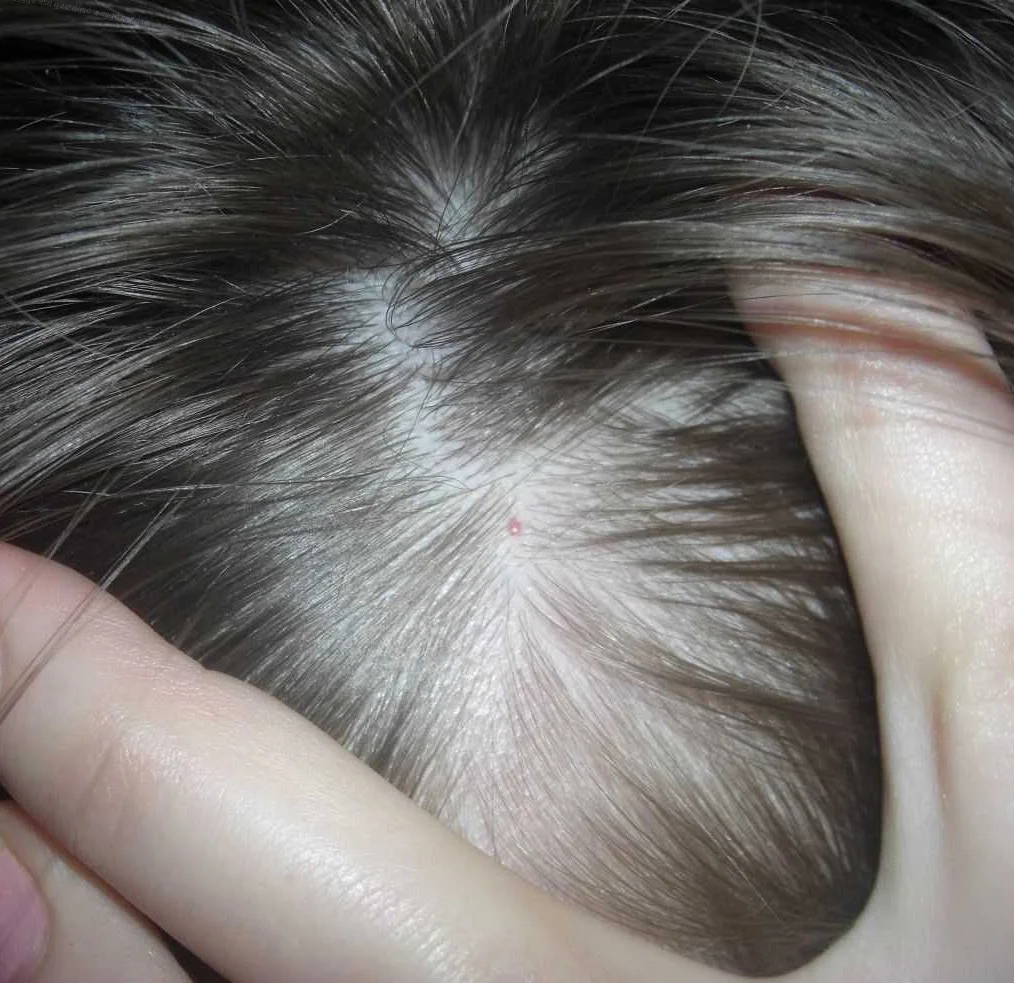 Профессиональные средства для устранения выпадения волос
