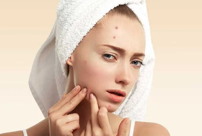 Советы для скрытия прыщей макияжем
