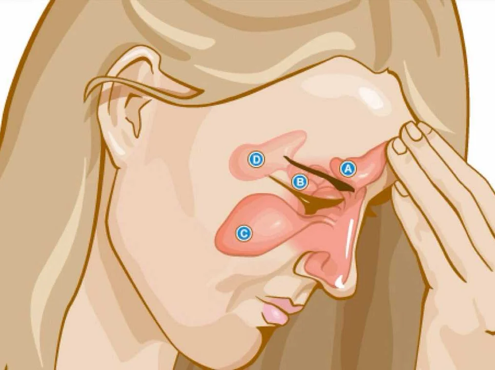 Народные средства для лечения проблем с носом